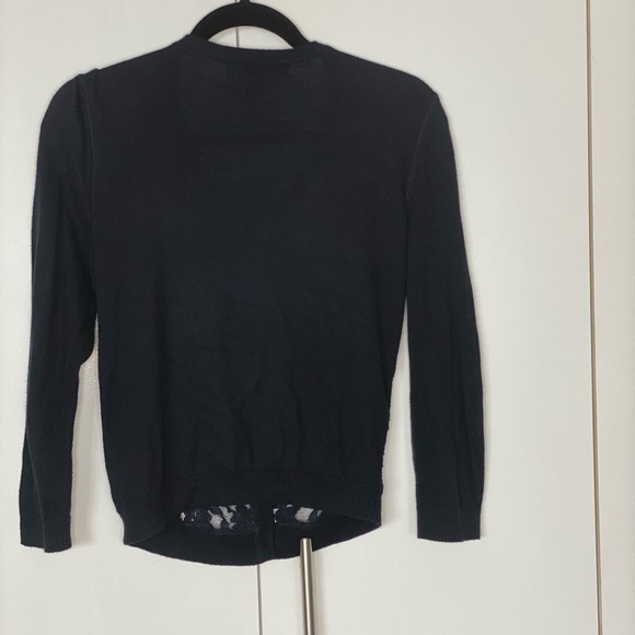 Forever21 Lace Detail Cardigan - Picture 3 of 3